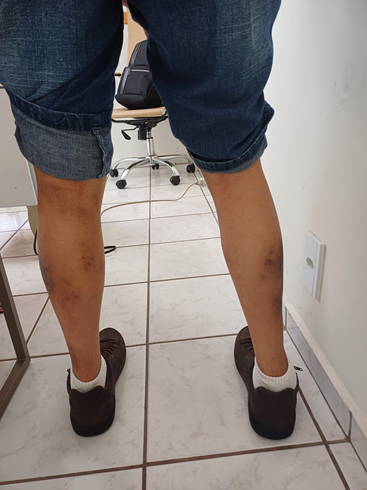Resultado de tratamento