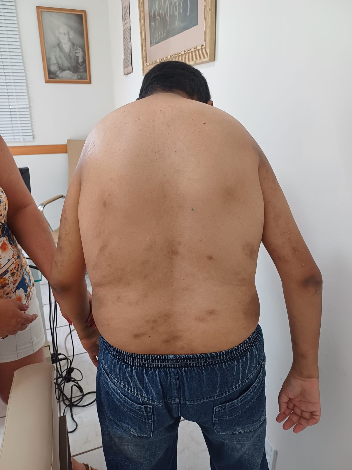 Resultado de tratamento