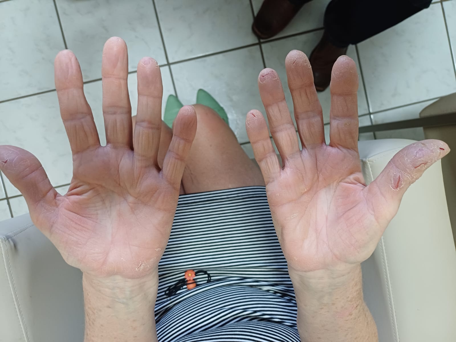 Resultado de tratamento