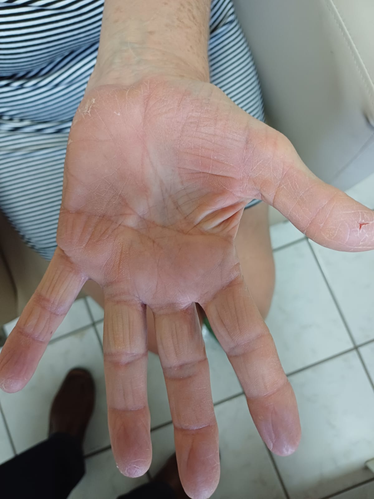 Resultado de tratamento